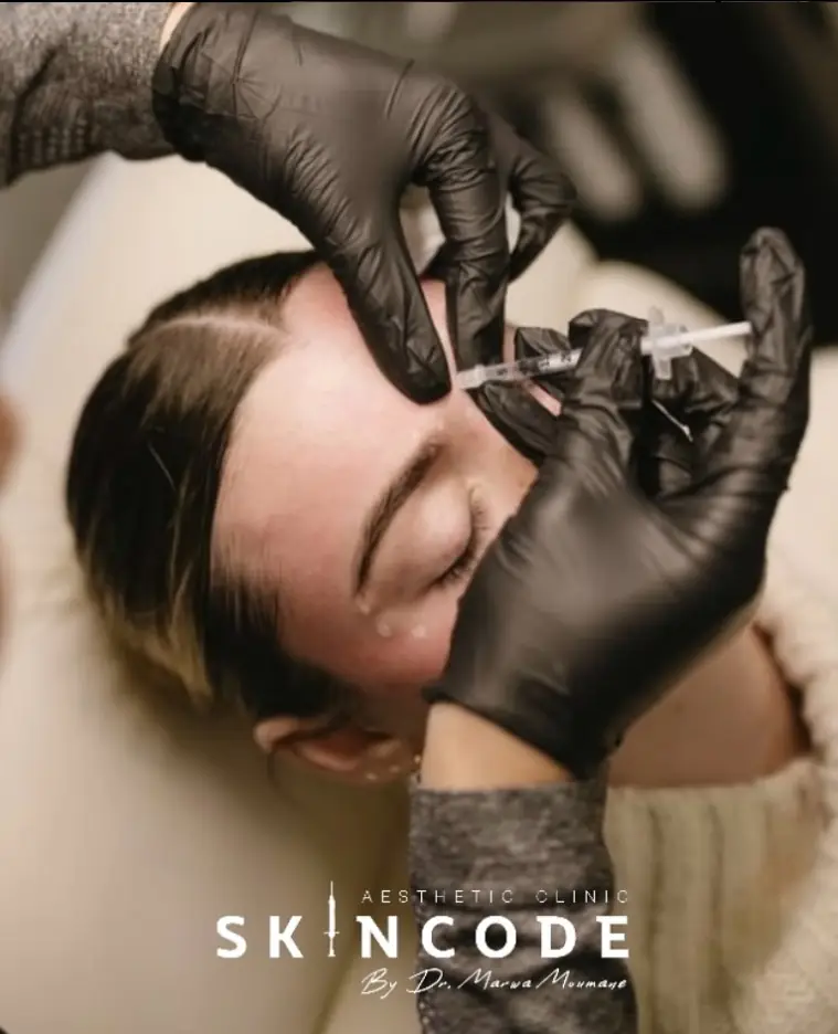 Injection dans le haut du visage par le médecin